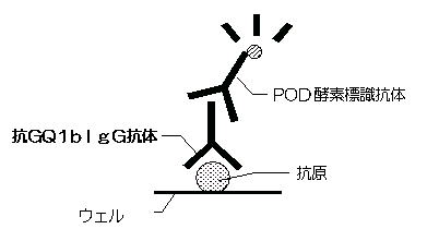 抗GQ1bIgG抗体検査の原理図